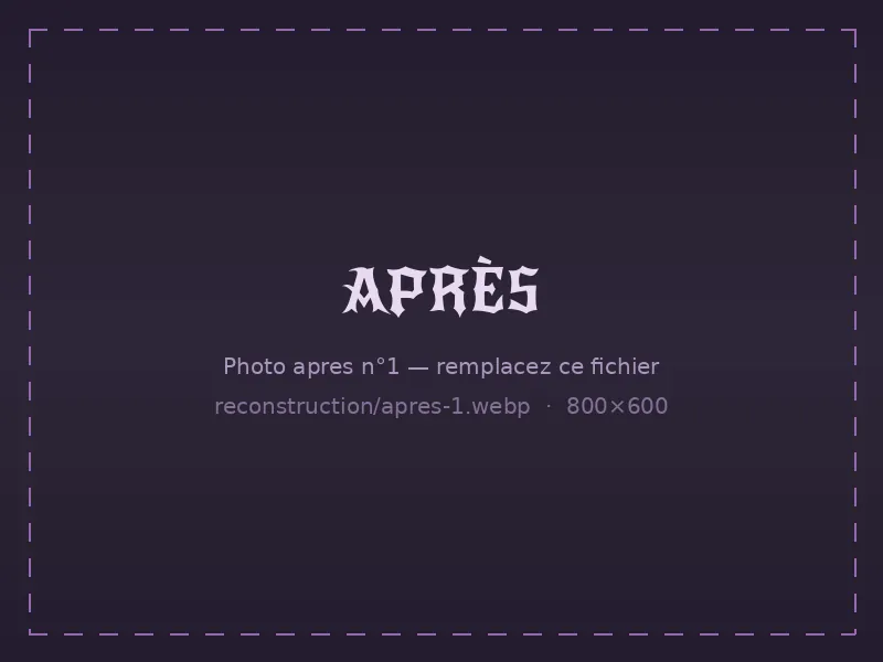 Ongles reconstruits en acrygel après soin — exemple 1